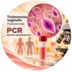 Trichomonas vaginalis — qualitative PCR determination