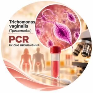 Trichomonas vaginalis — qualitative PCR determination