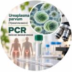 Ureaplasma parvum — qualitative PCR determination
