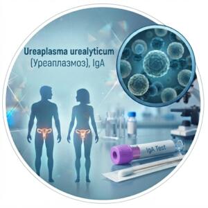 Медична інфографіка в синіх тонах для тесту на антитіла IgA до Ureaplasma urealyticum, із зображенням бактерій, пробірки з фіолетовою кришкою та силуетів людини
