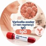 Медична інфографіка для аналізу на антитіла IgG до вірусу Varicella-zoster (3 тип герпесу) із зображенням висипань, вірусу та пробірки з кров'ю
