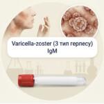 Медицинская инфографика для анализа антител IgM к вирусу Varicella-zoster (3 тип герпеса) с изображением высыпаний на теле, вируса под микроскопом и пробирки для крови