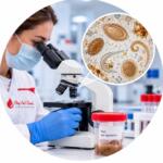 Detection of intestinal parasites and their eggs in laboratory testing — Medi Lab Plus