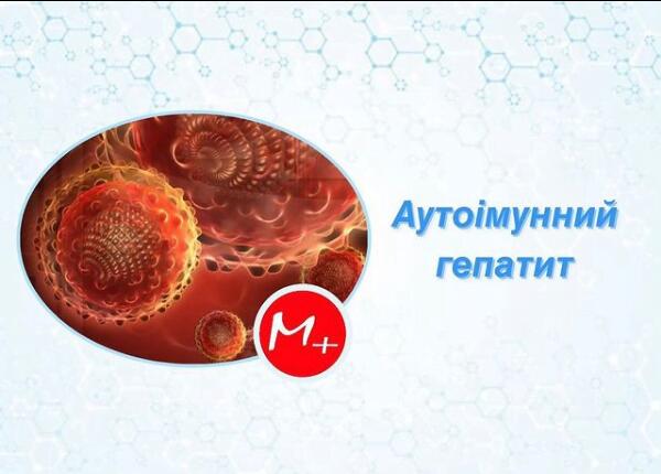 Аутоімунний гепатит