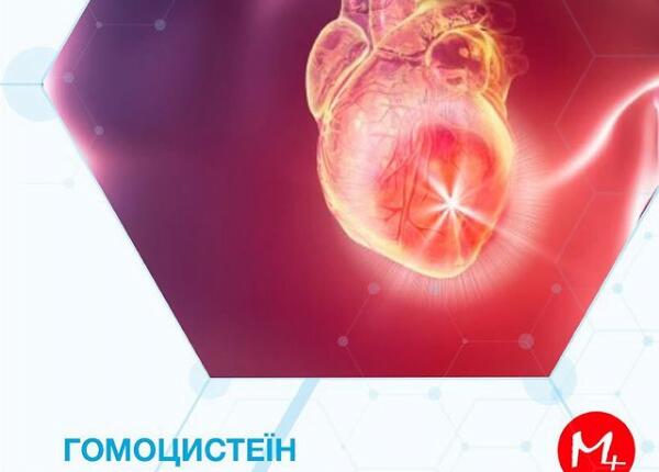 Гомоцистеїн