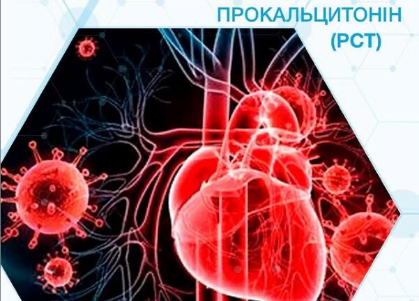 Прокальцитонін