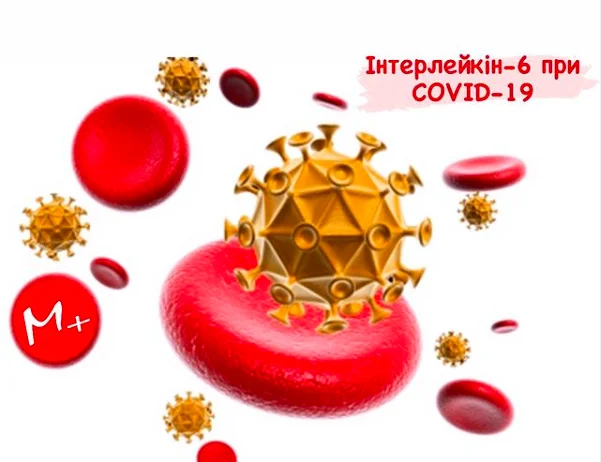 Інтерлейкін-6 при COVID-19