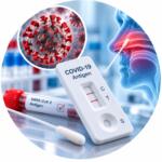 Антиген нового коронавірусу (2019-nCoV Antigen) — лабораторний аналіз