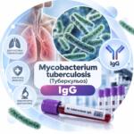 Антитіла IgG до Mycobacterium tuberculosis