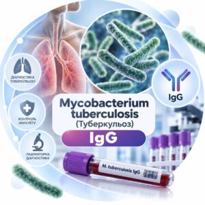 Антитіла IgG до Mycobacterium tuberculosis