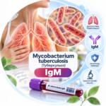 IgM до Mycobacterium tuberculosis — аналіз на туберкульоз