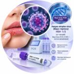 Herpes simplex virus HSV-1/2 — Real-time PCR, якісне визначення (у/г зішкріб)