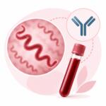 Anti-Treponema pallidum IgG — laboratory test