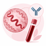 Anti-Treponema pallidum IgG — лабораторне дослідження