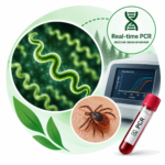 Borrelia burgdorferi sl (borreliosis) — Real-time PCR, qualitative detection