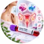 ROMA index analysis (CA-125 + HE4) — Medi Lab Plus