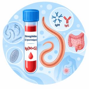 Strongyloides — антитіла IgM та IgG