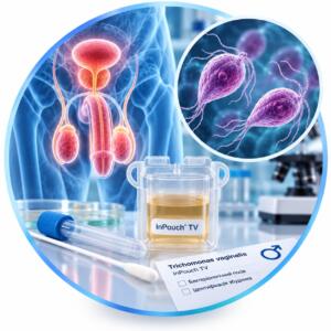 Аналіз посіву на Trichomonas vaginalis (InPouch TV) у чоловіків — Меді Лаб Плюс