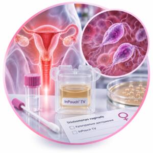 Аналіз посіву на Trichomonas vaginalis (InPouch TV) у жінок — Меді Лаб Плюс