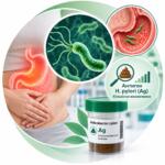 Helicobacter pylori Ag — кількісне визначення антигену Хелікобактер Пілорі