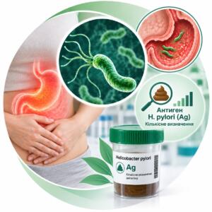 Helicobacter pylori Ag — кількісне визначення антигену Хелікобактер Пілорі
