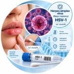 Herpes simplex virus HSV-1 — у/г зішкріб, Real-time PCR