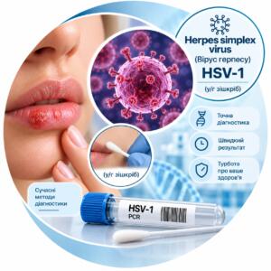 Herpes simplex virus HSV-1 — у/г зішкріб, Real-time PCR