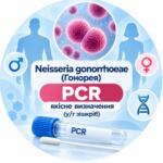 Neisseria gonorrhoeae — якісне PCR-визначення у/г зішкріб