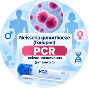 Neisseria gonorrhoeae — якісне PCR-визначення у/г зішкріб