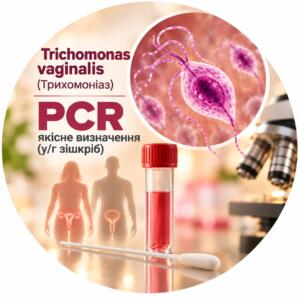 Trichomonas vaginalis — qualitative PCR determination in a scraping