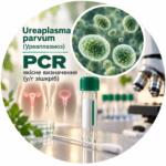Ureaplasma parvum — качественное PCR-определение в/х соскоб