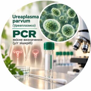 Ureaplasma parvum — якісне PCR-визначення у/г зішкріб