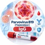 Parvovirus B19 — IgG antibodies