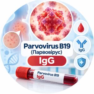 Parvovirus B19 — антитіла IgG