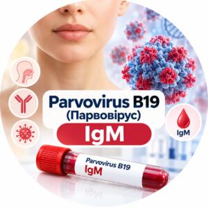 Parvovirus B19 - антитела IgM