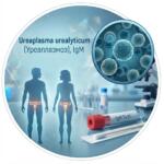 Медична графіка в синіх тонах для тесту на антитіла IgM до Ureaplasma urealyticum, із зображенням бактерій, пробірки та силуетів людини