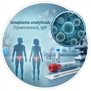 Medical graphics in blue tones for the Ureaplasma urealyticum IgM antibody test, with images of bacteria, test tube and human silhouettes