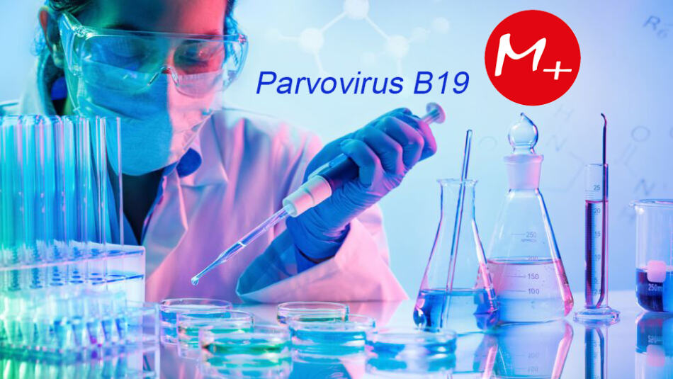 Parvovirus B19  1