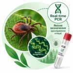 Borrelia burgdorferi sl (borreliosis) — Real-time PCR, tick research