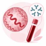 Anti-Treponema pallidum IgM — лабораторне дослідження