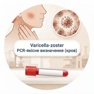 Медична інфографіка для якісної ПЛР-діагностики вірусу Varicella-zoster за зразком крові, із зображенням висипань, вірусу під мікроскопом та пробірки з кров'ю