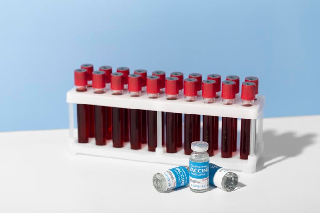Blood sample for calcium analysis in the laboratory