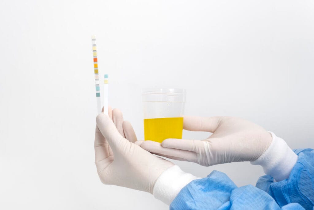 Urine analysis in the laboratory