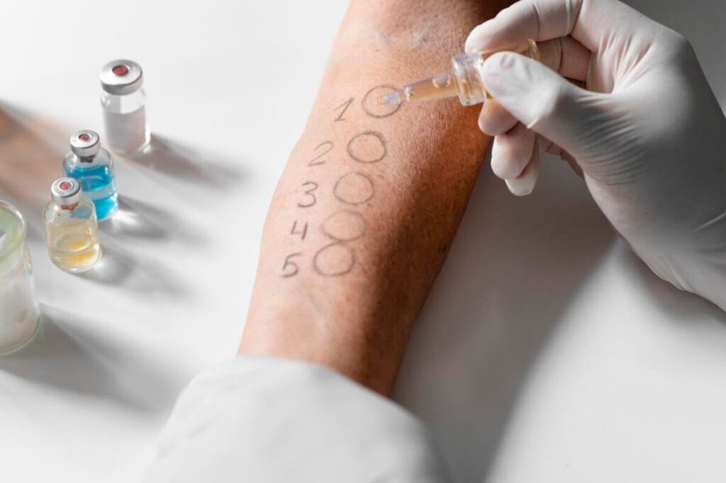 Laboratory blood test for allergies