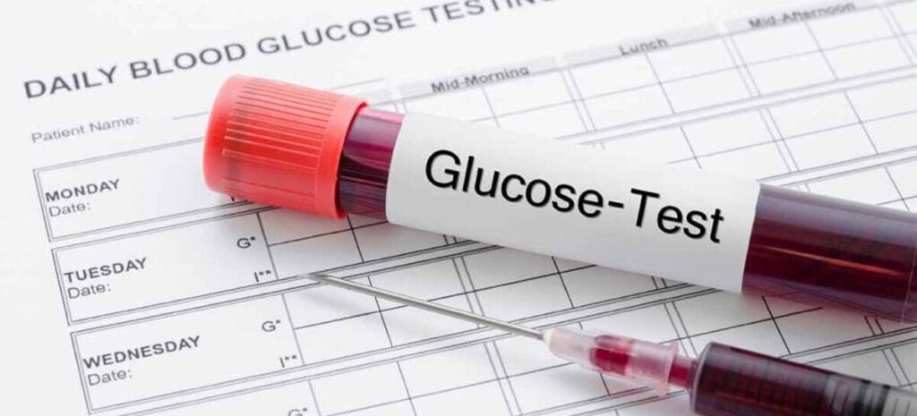 анализ крови на глюкозу в лаборатории