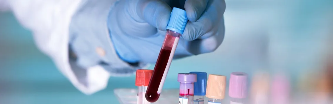 laboratory blood test for glucose level