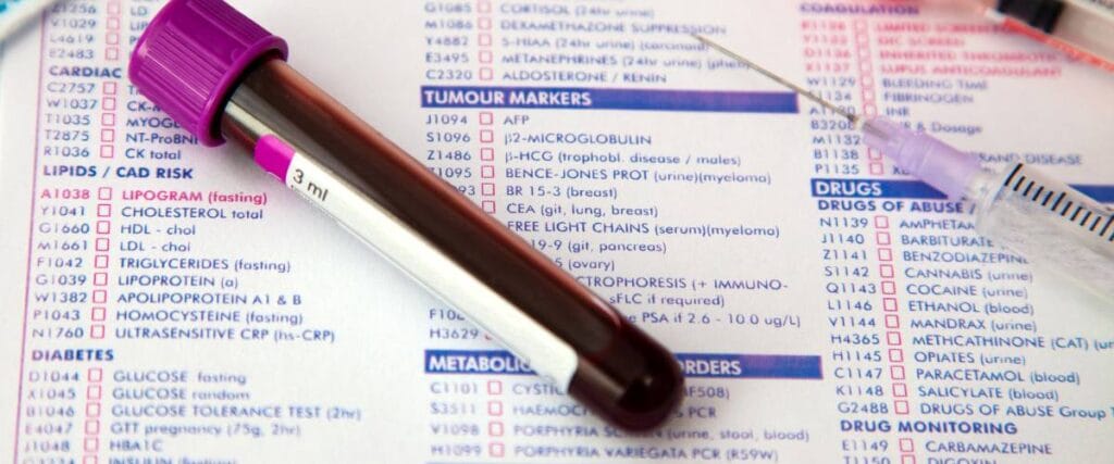 The doctor explains to the patient why the test should be taken on an empty stomach