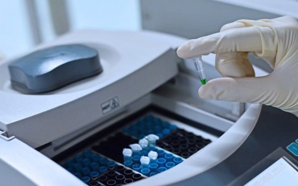 a laboratory specialist performs a PCR test for herpes