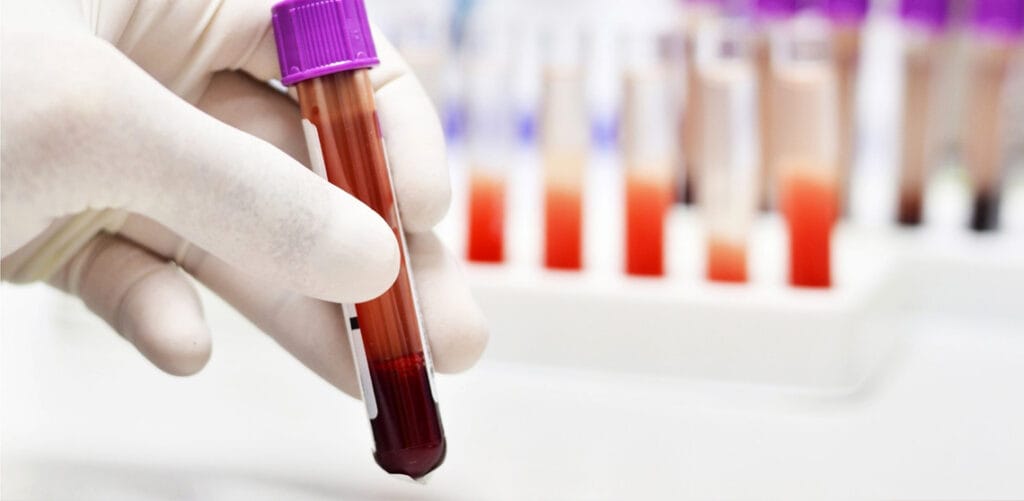 a patient takes a blood test in a laboratory