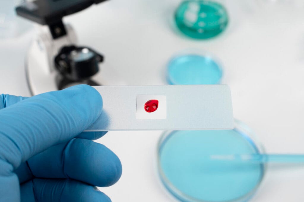 DNA molecule against the background of test results